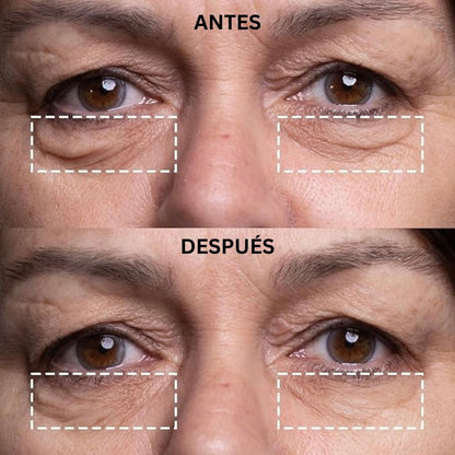Wrinkles - Parches faciales antiarrugas
